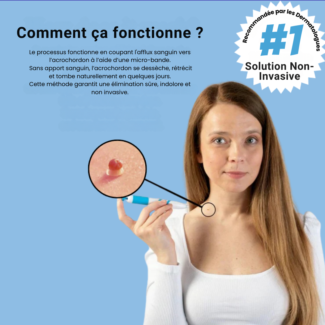 Kit de Suppression Acrochordons & anti-verrues