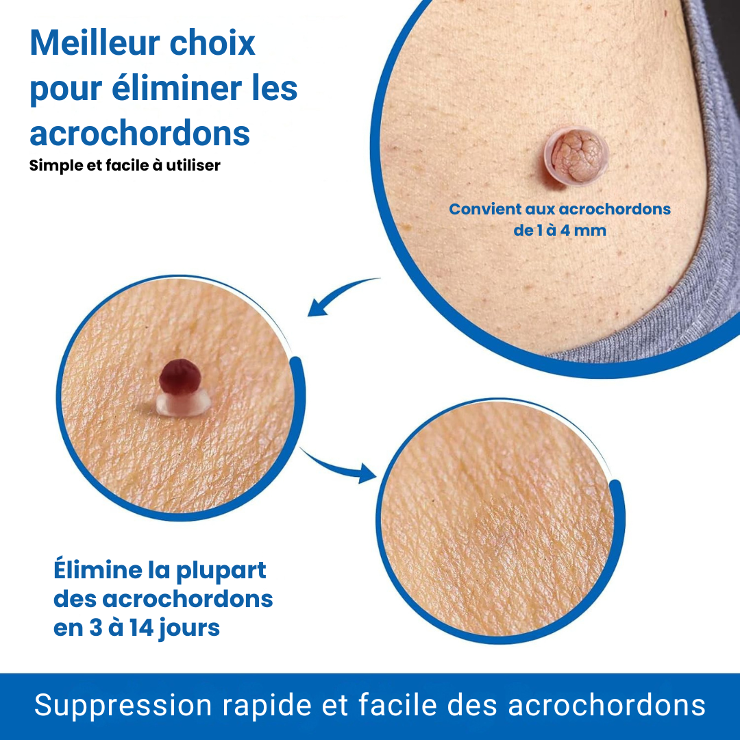 Kit de Suppression Acrochordons & anti-verrues